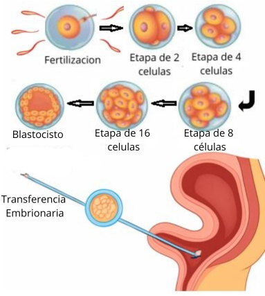 ¿Cómo se desarrolla una transferencia de embriones? 1