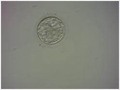Mejorando la calidad de los embriones para aumentar las tasas de fertilidad 2 Mejorando la calidad de los embriones para aumentar las tasas de fertilidad 2