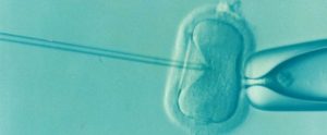 Lee más sobre el artículo ¿Cómo es la Microinyección espermática?
