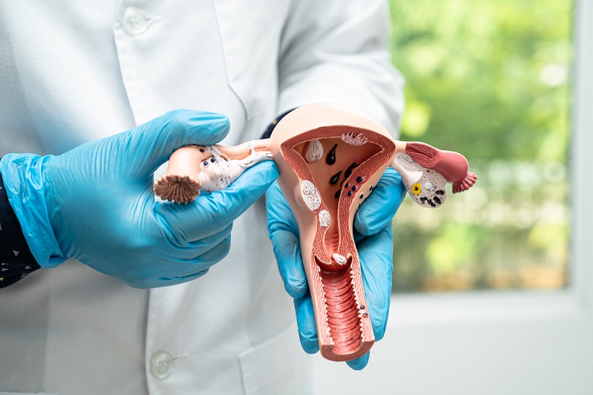 La punción ovárica: extracción de óvulos 2